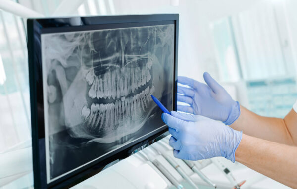 Dental X ray - Whitby dental office