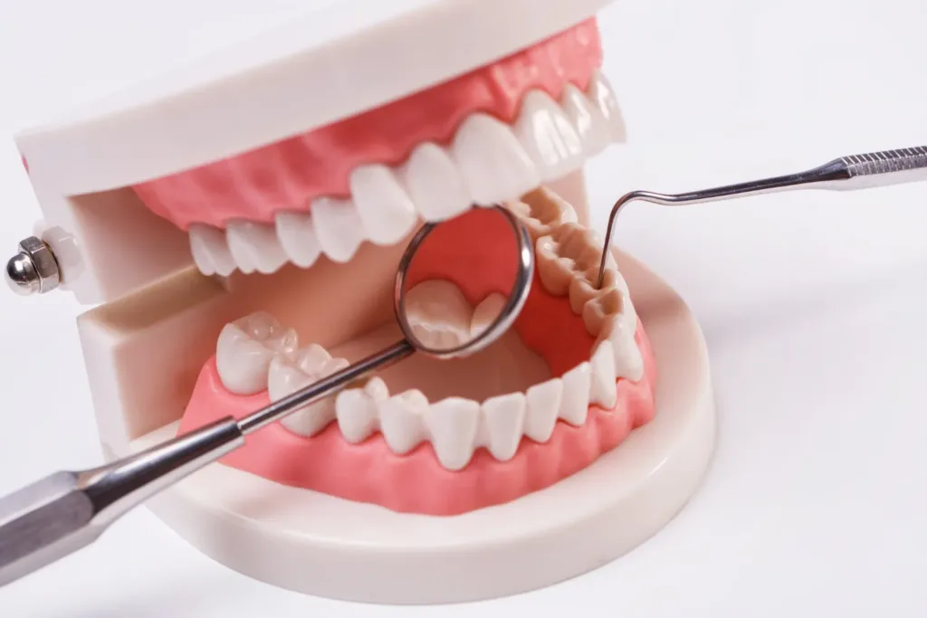 Systemic Effects of Neglected Dental Health