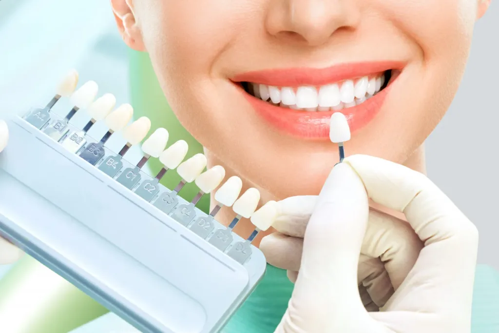 full arch dental implants in whitby,on