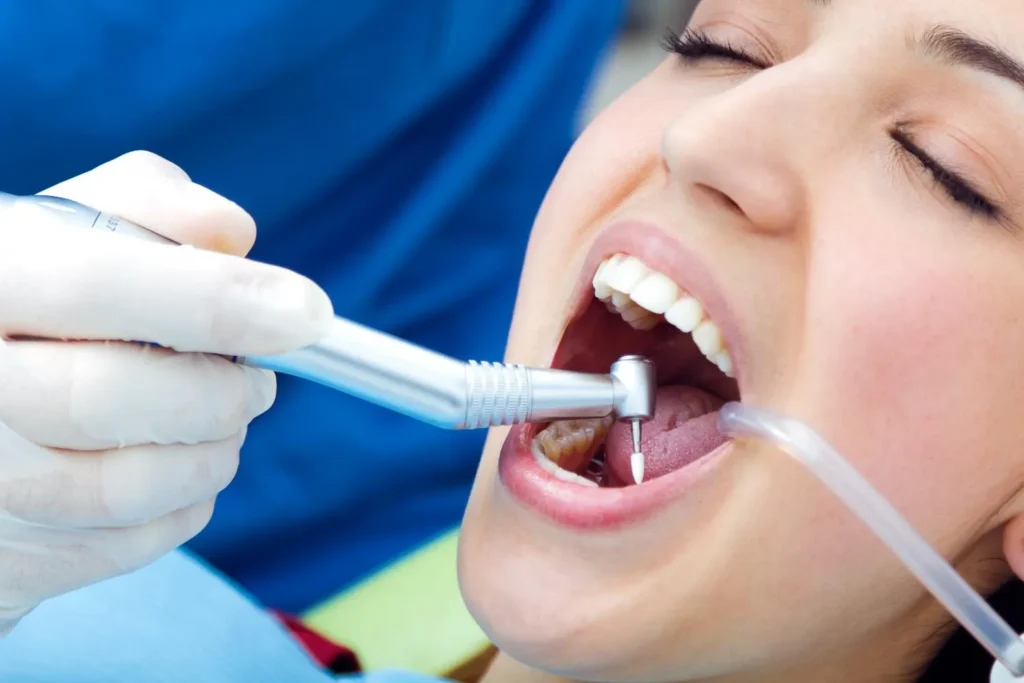 benefits of cleaning teeth at dentist