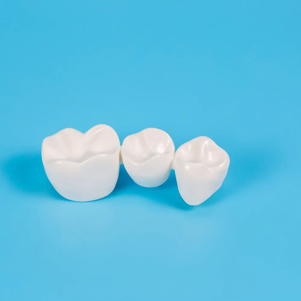 Crowns