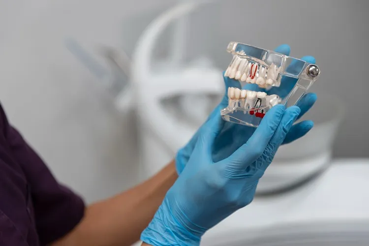 dental crowns in brooklin