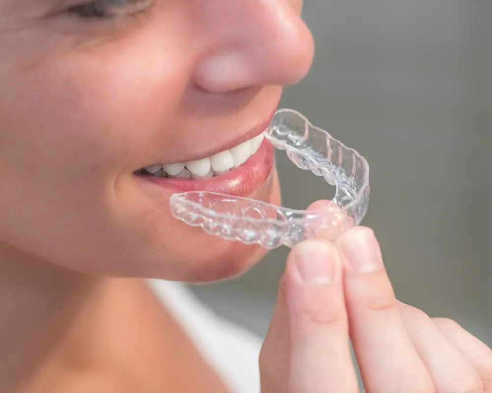 understand teeth braces cost