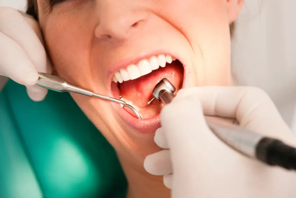best dental hygiene