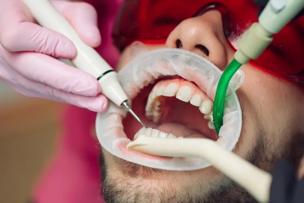 professional dentist teeth cleaning