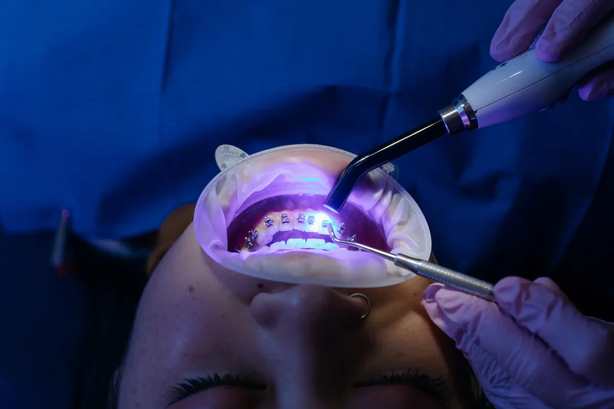 What is Gum Disease