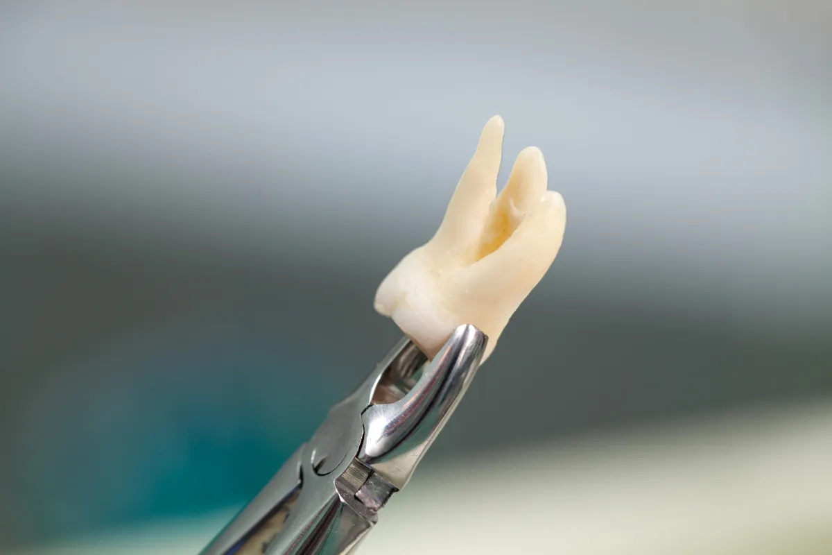 What is Gum Disease