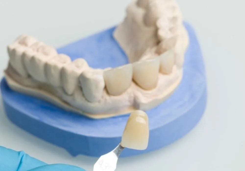 average cost of porcelain dental crown
