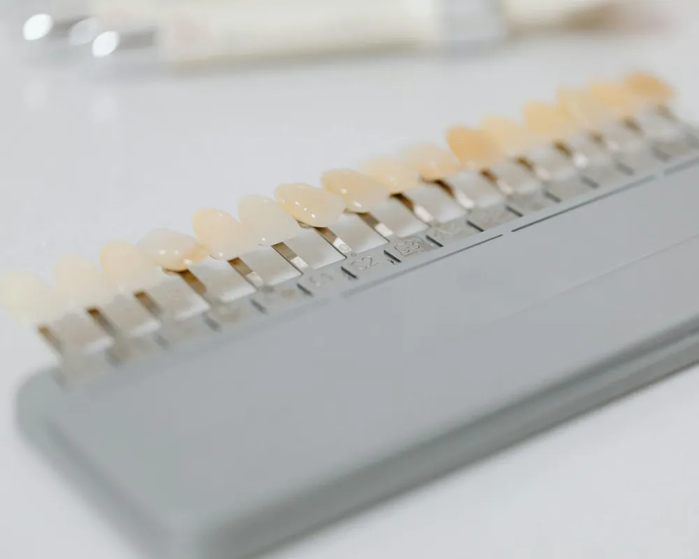 cost of dental veneer canada