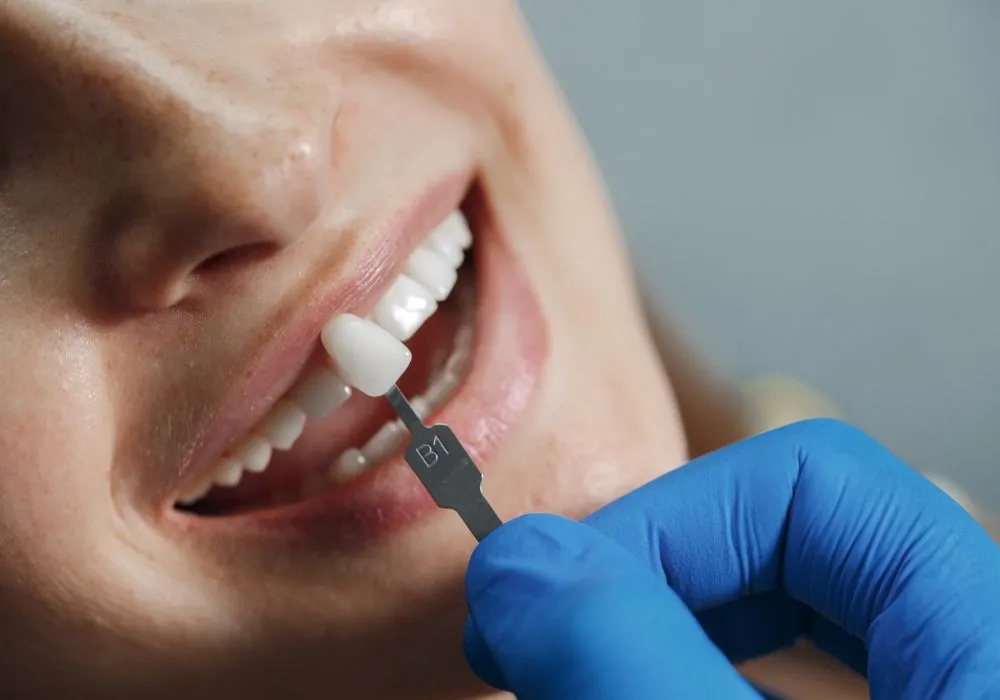 how much does a dental crown cost in canada